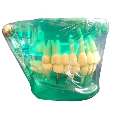 DTC Orthodontic Dental Typodont Brackets Model Custom Made voor handmatig en OEM