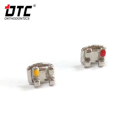 DTC Bright-serie metalen beugels De sleutel tot succesvolle orthodontische behandeling van klasse II
