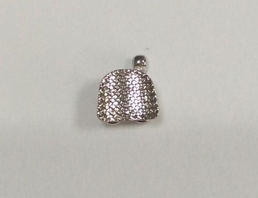 Standaard metalen beugelbeugels voor effectieve orthodontische correctie