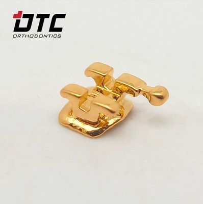 Ervaar de beste orthodontische behandeling met de CE-gecertificeerde gouden beugels van DTC Ortho