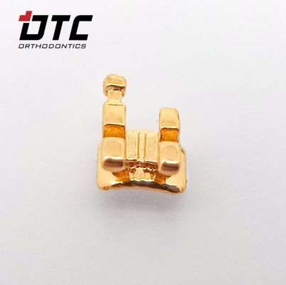 Ervaar de beste orthodontische behandeling met de CE-gecertificeerde gouden beugels van DTC Ortho