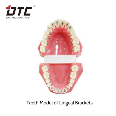 CE-standaard DTC-ortodontische tongbeugels voor mini-grootte orthodontische behandeling