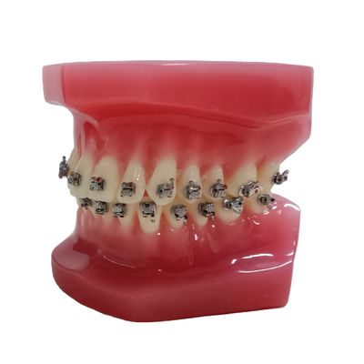 DTC Orthodontic Dental Typodont Brackets Model Custom Made voor handmatig en OEM