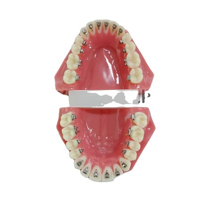 DTC Orthodontic Dental Typodont Brackets Model Custom Made voor handmatig en OEM